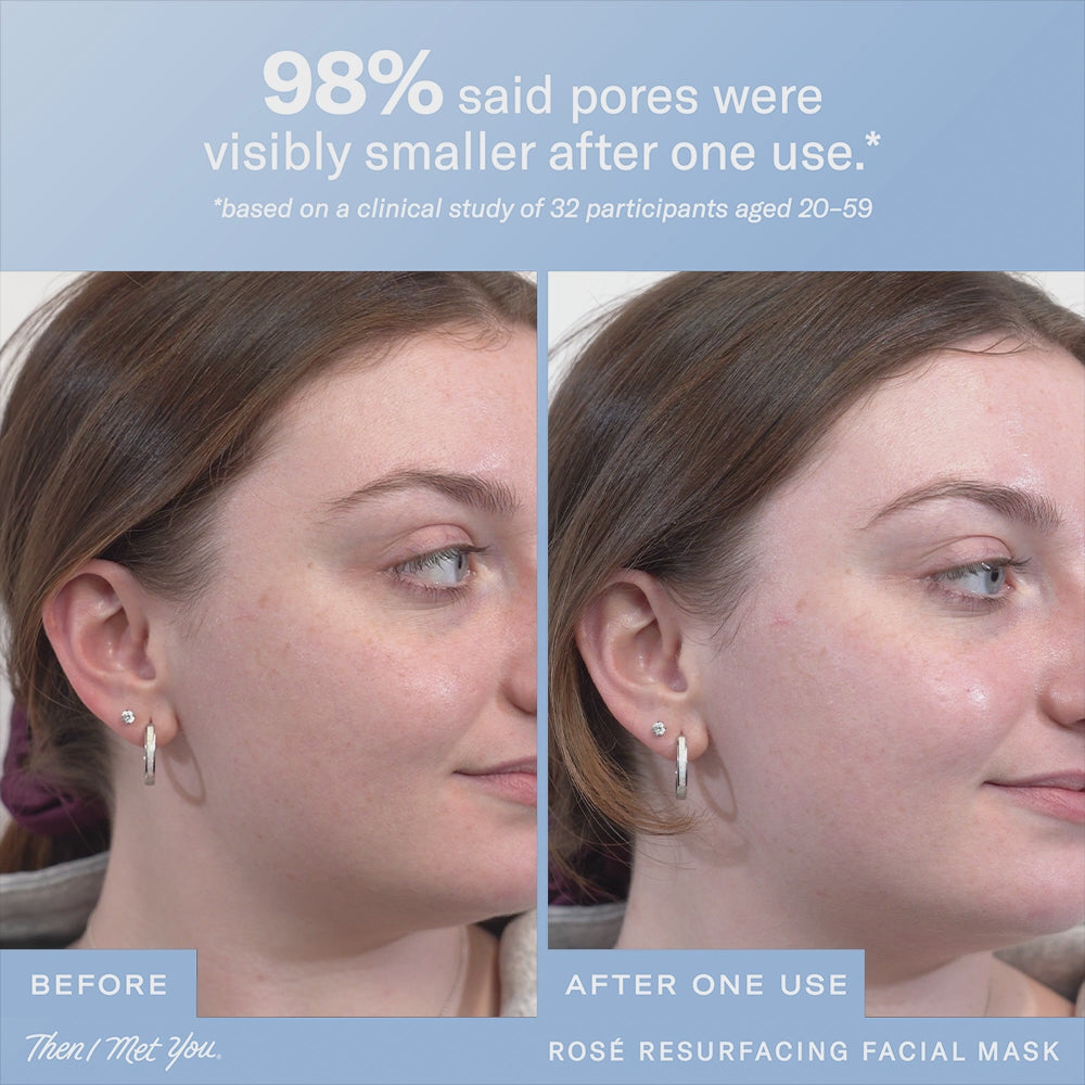 Rosé Resurfacing Facial Mask
